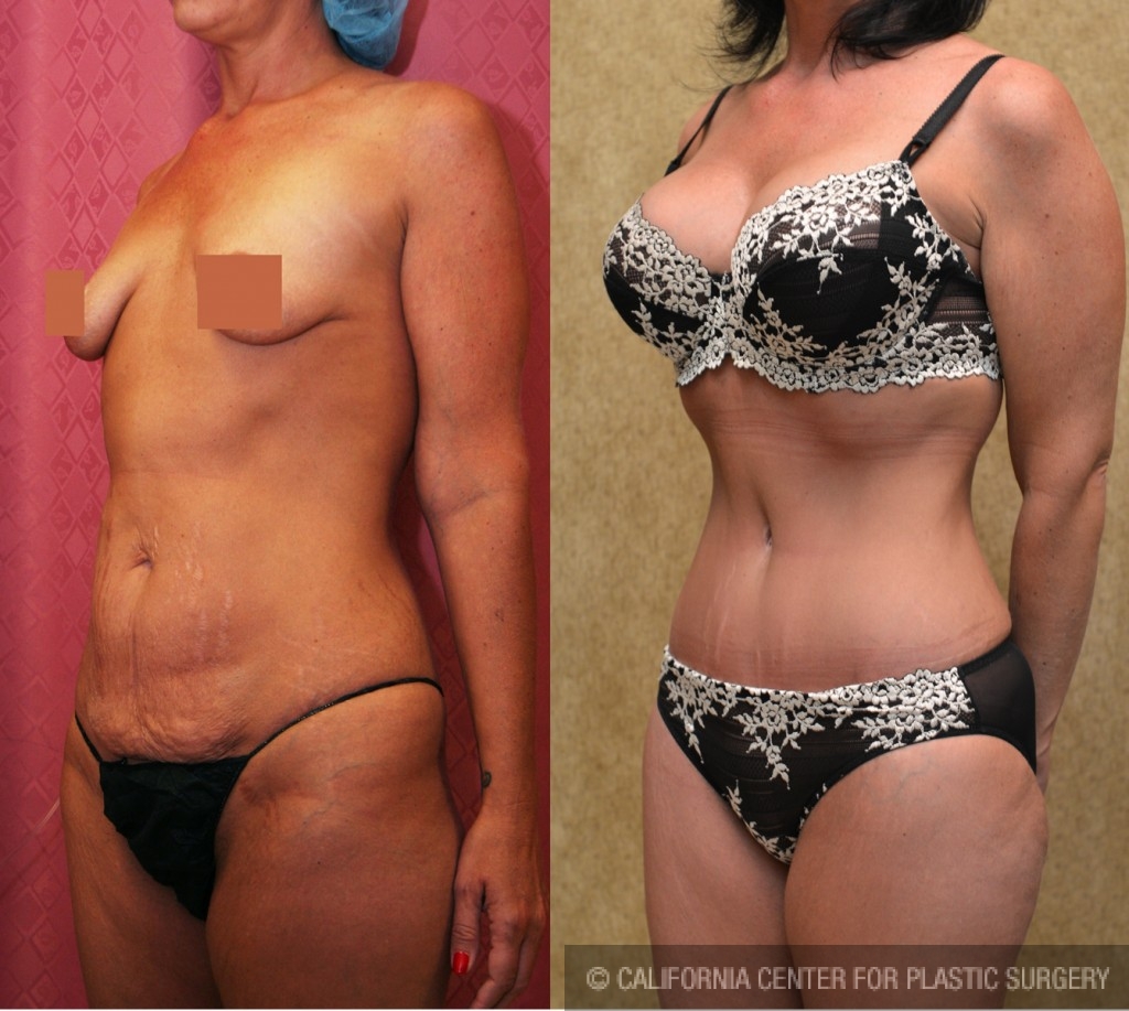 Trussler Plastic Surgery For Body