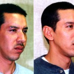 Male Rhinoplasty Before & After Patient #6401