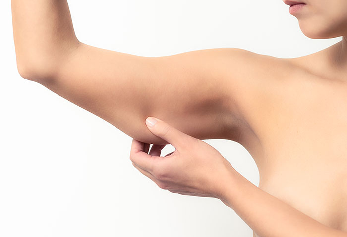 liposuction under the arms