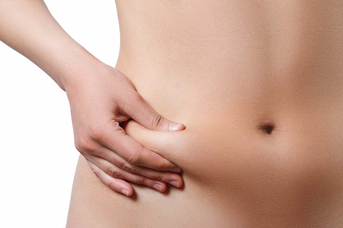 Best FUPA Liposuction Los Angeles & Beverly Hills