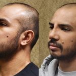 Rhinoplasty - Hispanic Before & After Patient #14119