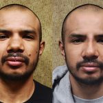 Rhinoplasty - Hispanic Before & After Patient #14119